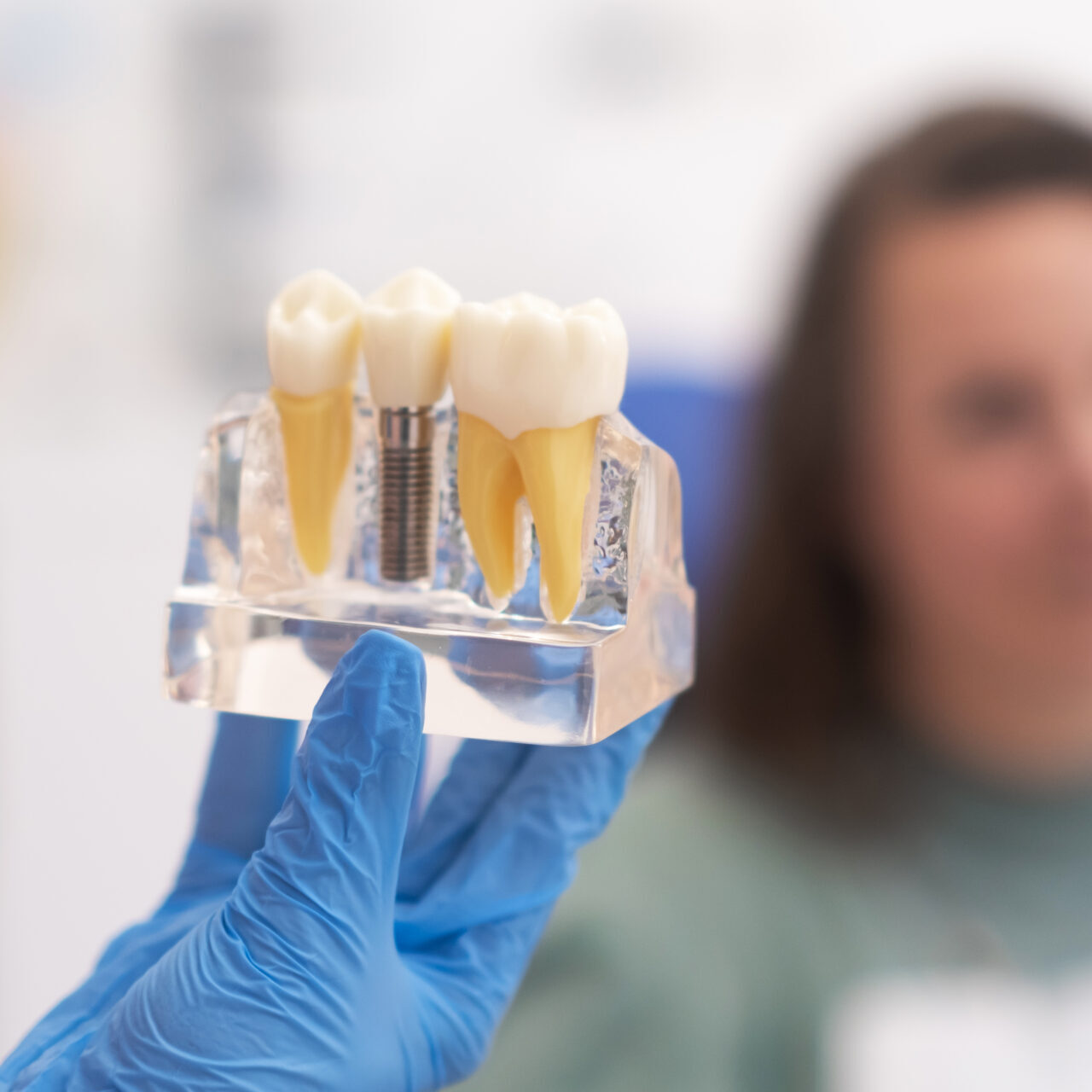 Dental implants